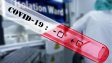 Лошо: 194 нови случая на коронавирус, 7 души са починали 