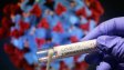 87 нови случая на коронавирус в България