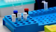 286 нови случая на коронавирус в България 