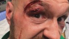 Битката на века: Има ли опасност аркадата на Фюри да го провали срещу Усик?  