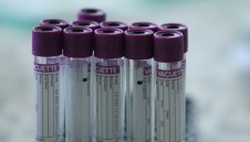 Още 10 нови случая на COVID-19 в България