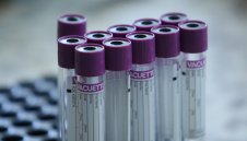 Коронавирус: Още 20 случая в България, заразените са 1778