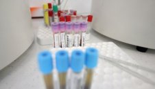 8932 са новите случаи на коронавирус у нас