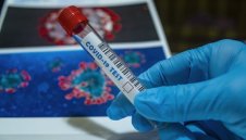 Лошо: 1004 нови случая на коронавирус, над 3300 са в болница