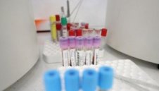 Става страшно: Мач в Бразилия беше отложен заради 14 положителни проби за коронавирус 