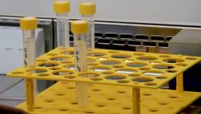 Тъжно: Още 60 души починаха от коронавирус в България