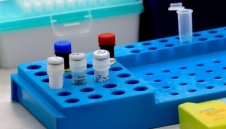 Коронавирус: Нови 69 случая в България