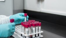 Лошо: Нови 196 случая на коронавирус у нас, двама души починаха