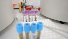 Спад на случаите: 2370 новозаразени с коронавирус