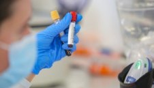 1443 са новозаразените с коронавирус