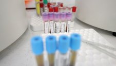 196 нови случаи на коронавирус в България 