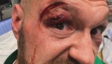 Ще има ли битка Фюри - Усик или ни очаква ново разочарование?