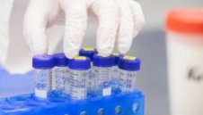 57 нови случаи на коронавирус, няма починали за последните 24 часа