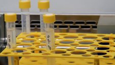 240 нови случая на коронавирус в България 