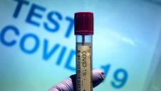 Лошо: 10 жертви от коронавирус, новите случаи са 154 