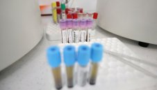 Лошо: 1891 са новите случаи на коронавирус у нас