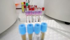 4,5% положителни за коронавирус, 627 излекувани, 24 починали