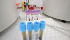 Лошо: 3440 са новите случаи с коронавирус