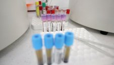 21% от тестваните у нас са с коронавирус