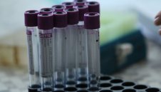 Лоши новини: 105 са новите случаи на коронавирус у нас, а четирима са починали