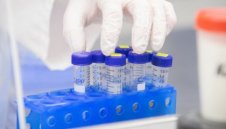 1235 са новозаразените с коронавирус