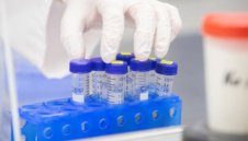 Отново висок брой на новозаразени с коронавирус 