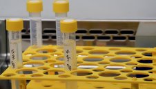 560 новозаразени с коронавирус за денонощие, починали са 29 души