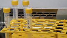 2126 нови случая на COVID, 3642 са се излекували