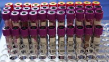 99 са новите случаи на коронавирус при направени 4787 теста