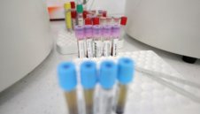 Лек спад: 719 са новите случаи на коронавирус