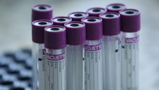 Тъжно: Още двама души починаха от коронавирус в България