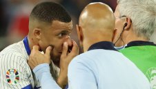 Мбапе проговори за потрошения си нос