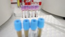 Лоши новини: 48 работнички от цеха в Доспат са с коронавирус