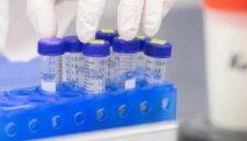 913 нови случая на коронавирус в България