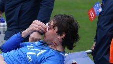 Счупен нос: Играч на Левски претърпя успешна операция