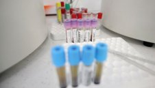 4637 с коронавирус, рекорден брой са в болница - 7269