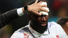 Рюдигер е със затворено око и 20 шева от Варшава