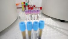 406 са новите случаи на коронавирус, направени са 13 839 теста