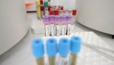 Лошо: Бивш треньор на Бразилия и Реал Мадрид е с коронавирус