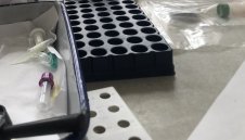 121 нови случая на коронавирус в България