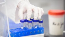 157 са новите случаи с коронавирус у нас