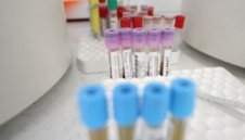 Лошо: Новите заразени с коронавирус са 128, един е починал