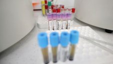 161 са новите случаи на коронавирус в България