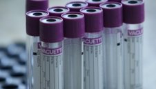 Лошо: Още 130 души с коронавирус в България, един е починал