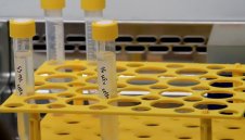 1463 са новите случаи на коронавирус в България