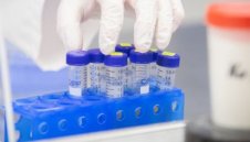 8116 са новозаразените с коронавирус