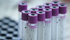 86 нови случая на коронавирус в България 