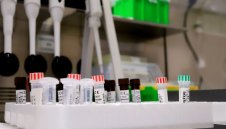 Новите случаи на коронавирус у нас са 683 