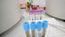 Лоши новини: Осем починали от коронавирус у нас, 79 са новите случаи