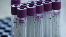 Трагично: Още трима починаха от коронавирус в България